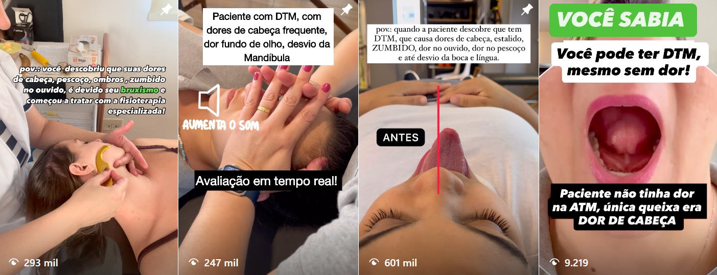 Prints de Reels do Instagram @drapatriciaferrari sobre DTM, bruxismo e avaliação em tempo real